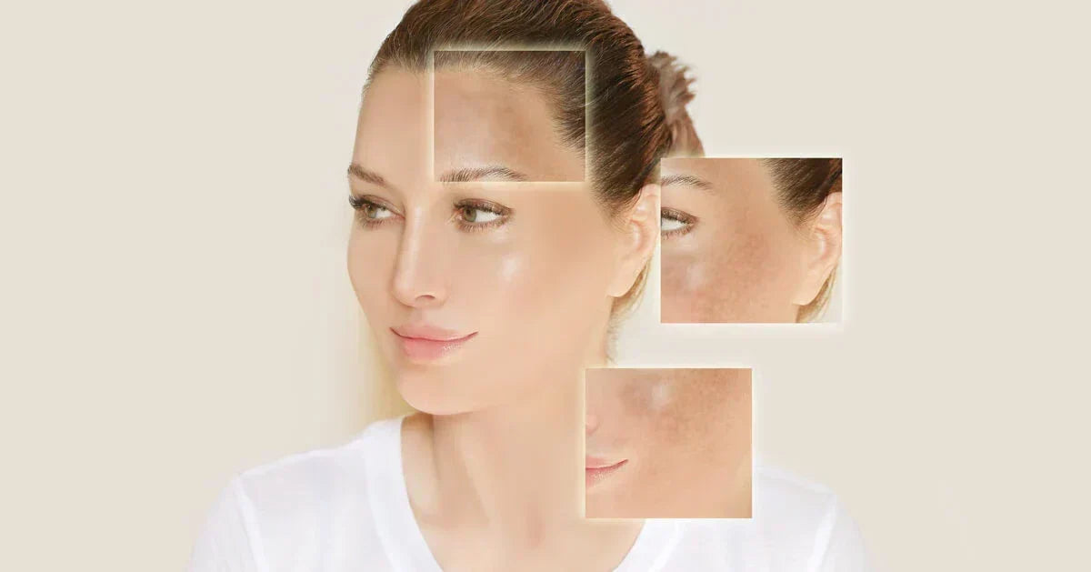 Co na przebarwienia? Kompleksowe i naukowo potwierdzone podejście do redukcji przebarwień skóry