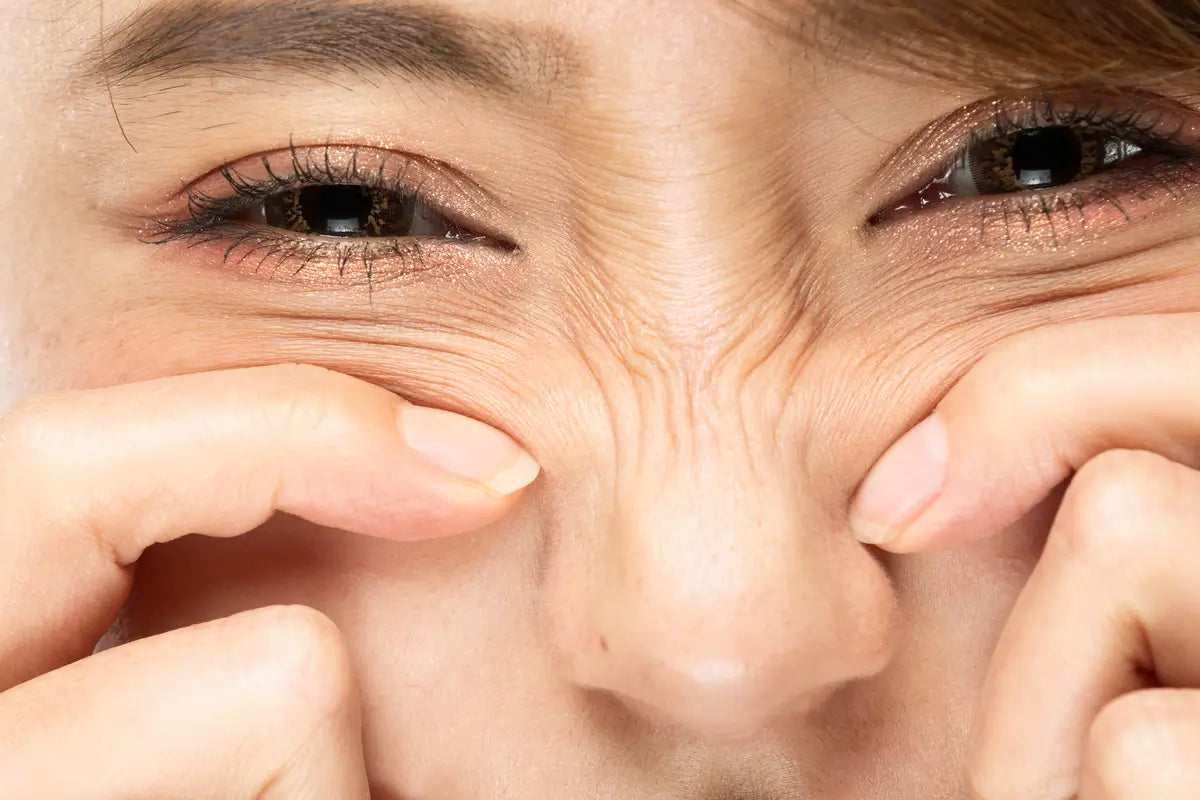 Królicze zmarszczki - co to jest i jak je wygładzić?