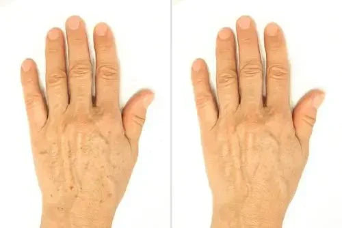 PLAMY STARCZE - CO TO JEST? - Orientana