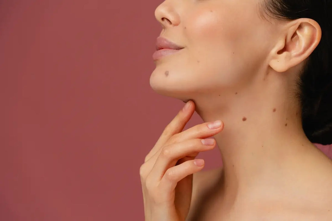 Bolesny pieprzyk - co oznacza, czy jest groźny i kiedy zgłosić się do dermatologa?