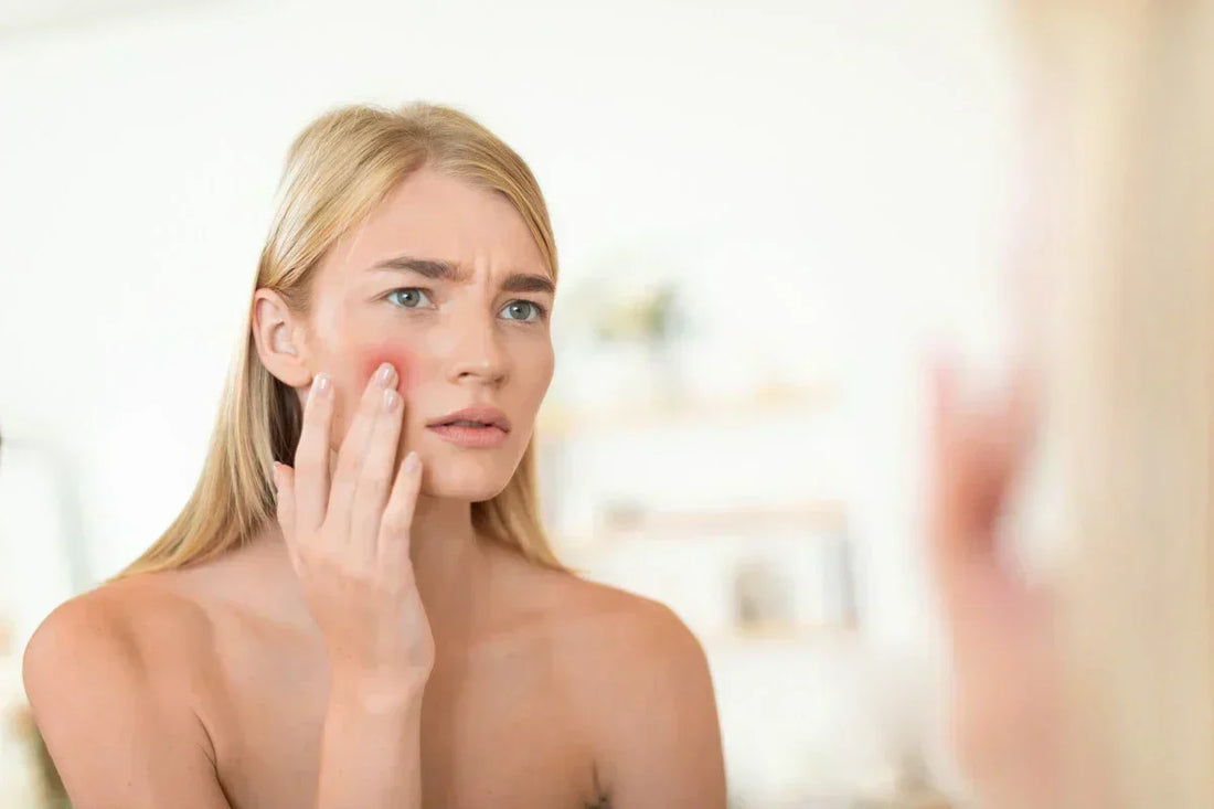 Czerwone plamy na twarzy - przyczyny, pielęgnacja i skuteczne kosmetyki naturalne
