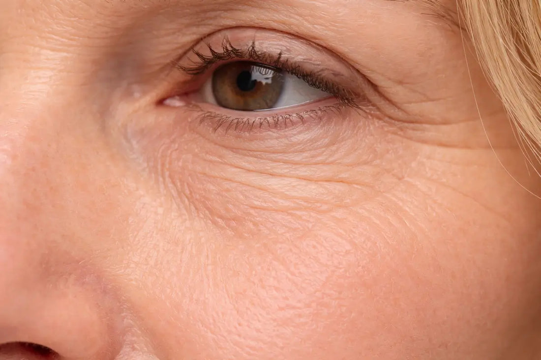 Skóra pergaminowa - co to jest, jak wygląda i jak ją pielęgnować?