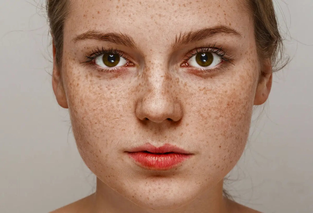 Piegi - skąd się biorą, co oznaczają i jak o nie dbać?