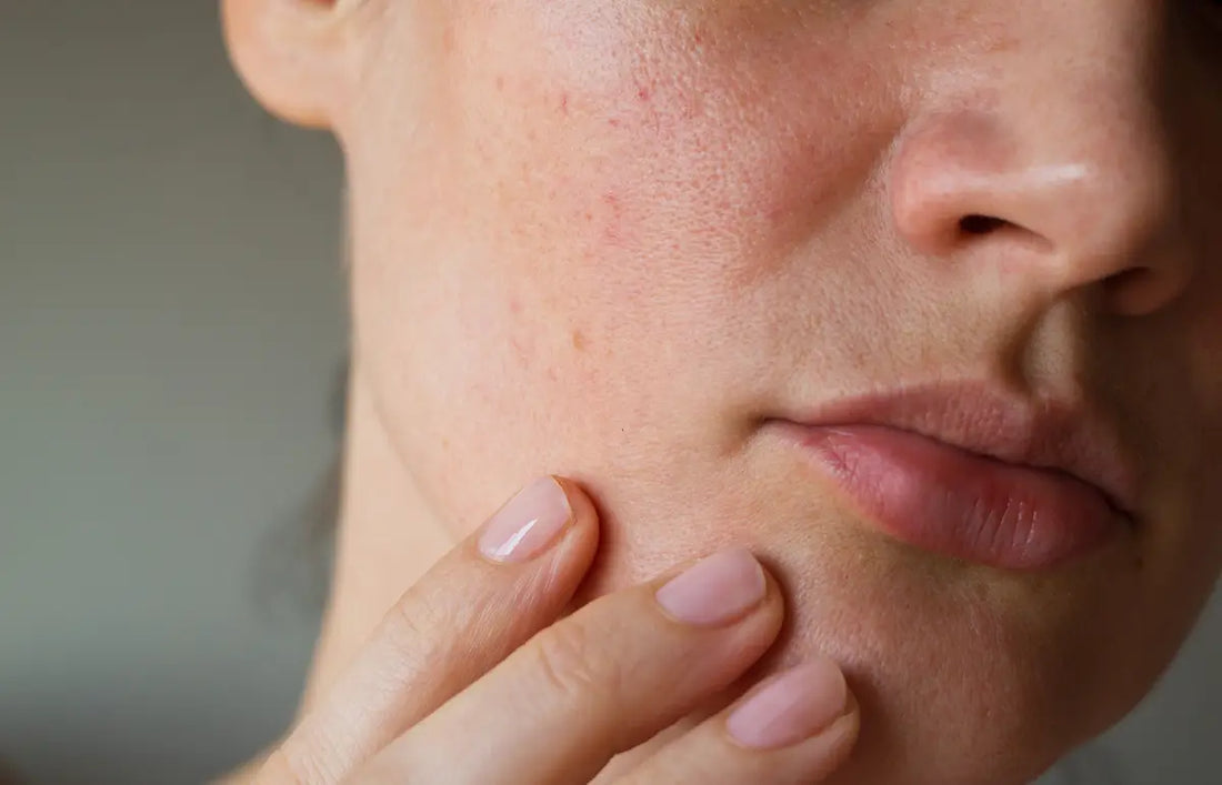 Sebum - co to jest i jak wpływa na kondycję skóry?