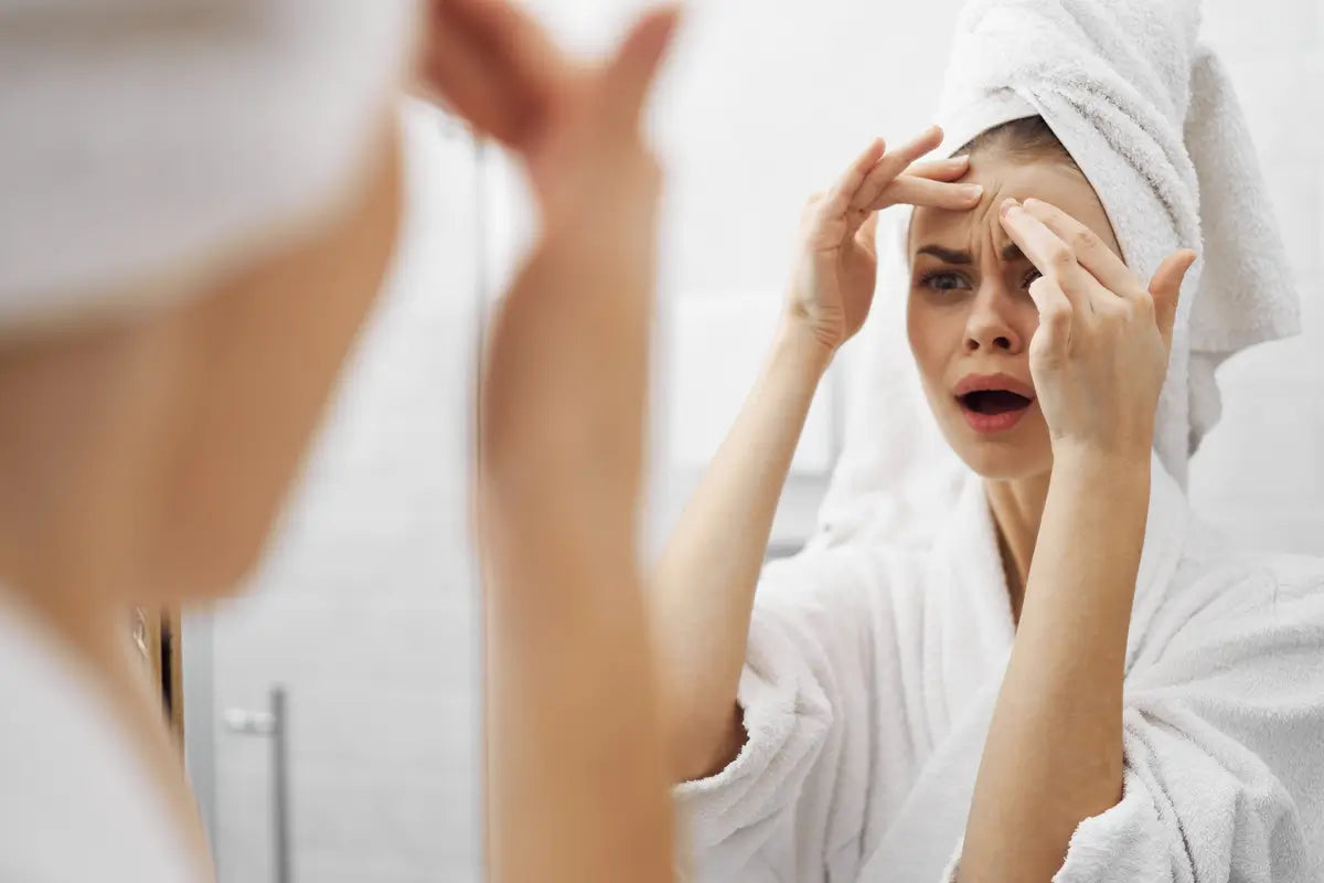 Wyciskanie pryszczy - dlaczego to najgorsze, co możesz zrobić swojej skórze?
