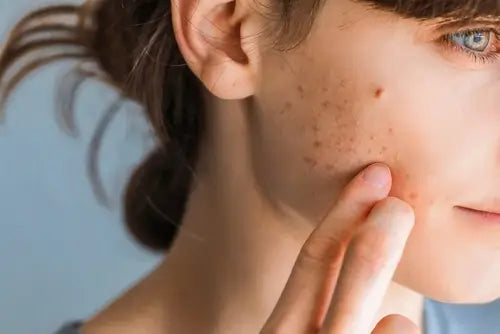 skóra twarzy z widocznymi zaskórnikami|pianka do mycia twarzy w użyciu|konsystencja serum ampułki nawilżenie|Nawadniające serum Tremella egzosomy|krem do twarzy regulujący sebum Tremella|maska do twarzy na niedoskonałości tremella