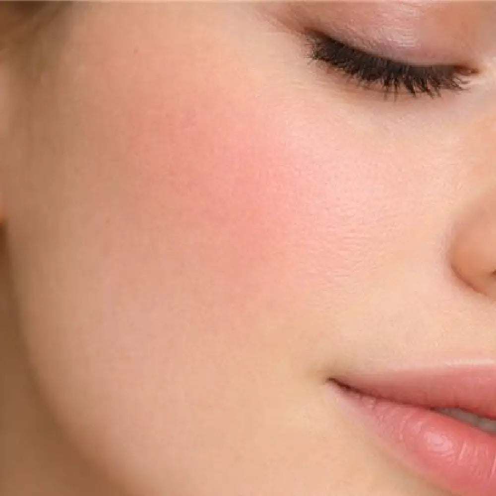 skóra wrażliwa i podrażniona po zastosowaniu serum kojącego orientana