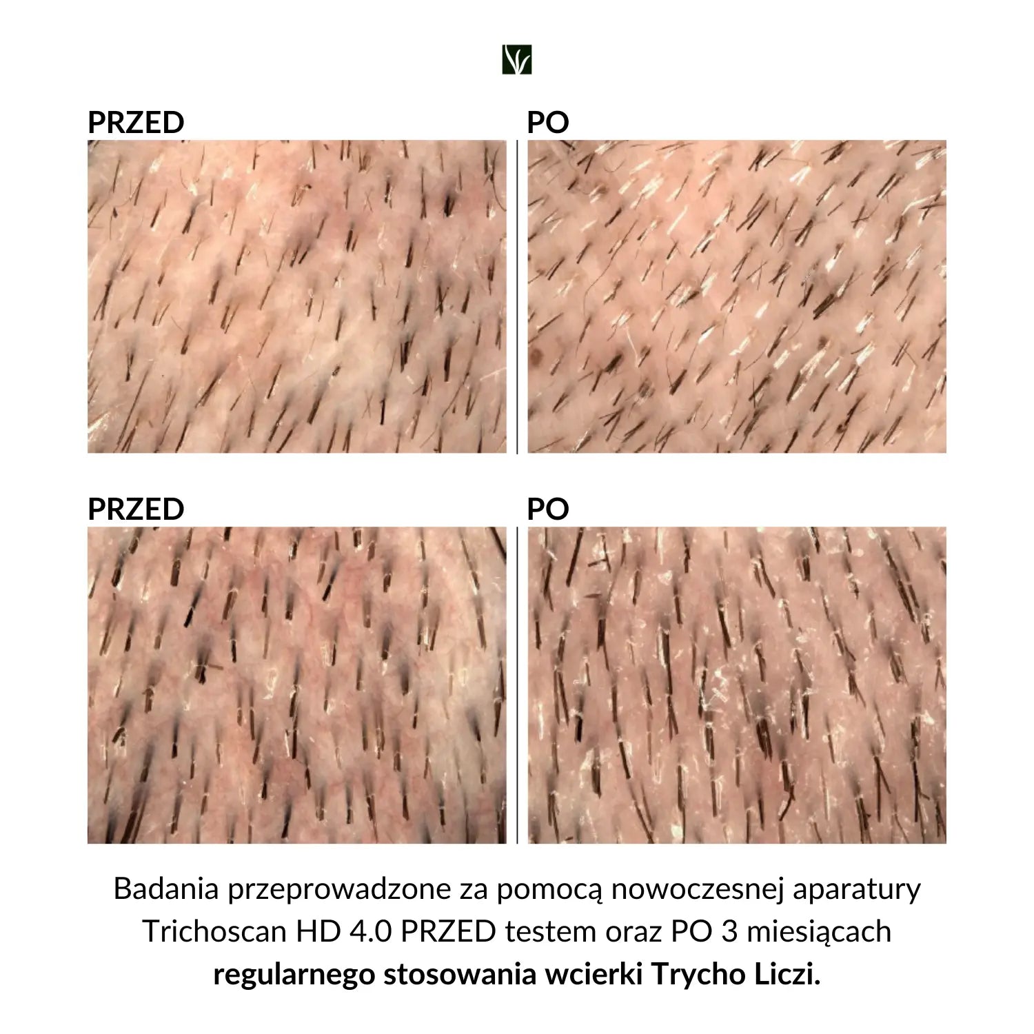 Trychologiczna wcierka do włosów Liczi Arginina Baicapil Mleczan Sodu 100 ml - Orientana